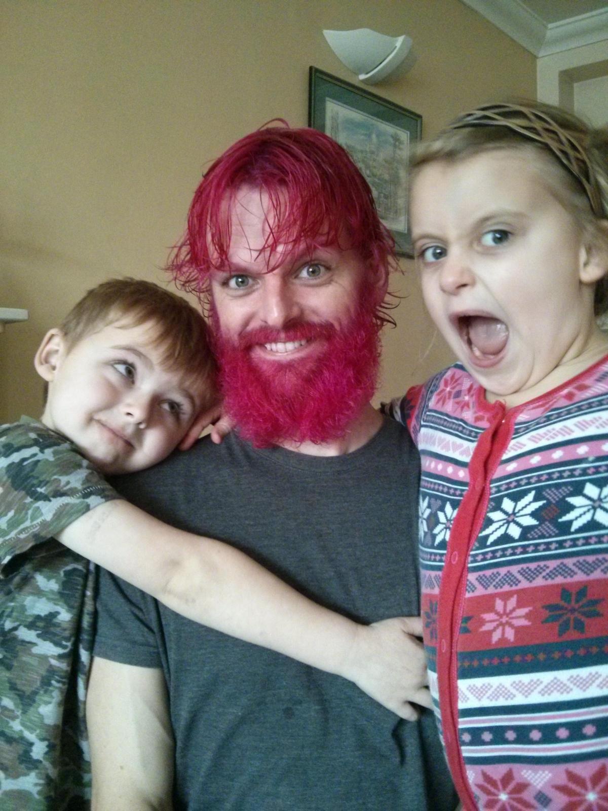 Having grown his all hair, Matt Ketteringham, IT Consultant at Provident Financial, allowed his children to dye it all pink (including eyebrows!) for Comic Relief and has embarked on gradual shaving sessions to culminate in no hair at all today