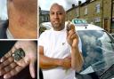 Taxi driver Sarfraz Khan got hit in the neck by a stone thrown on Wakefield Road, Bradford, on Saturday morning