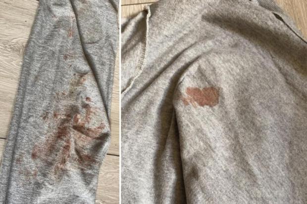 Bradford Telegraph and Argus: Blood and mud on Peter Kane's clothes