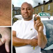 Taxi driver Sarfraz Khan got hit in the neck by a stone thrown on Wakefield Road, Bradford, on Saturday morning