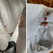 Blood on the girls' clothes