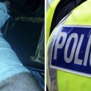 Police are investigating after Abid Beecroft said he suffered a ruptured Achilles tendon when he was 'run over' in Bradford